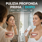 ✨💧 50% DI SCONTO! Idropulsore Dentale Wireless